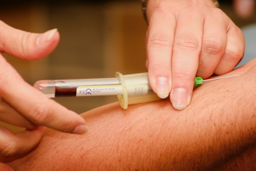 Man having blood drawn to test his homocysteine levels.